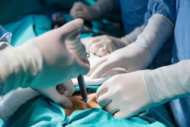 Thyroid Surgery